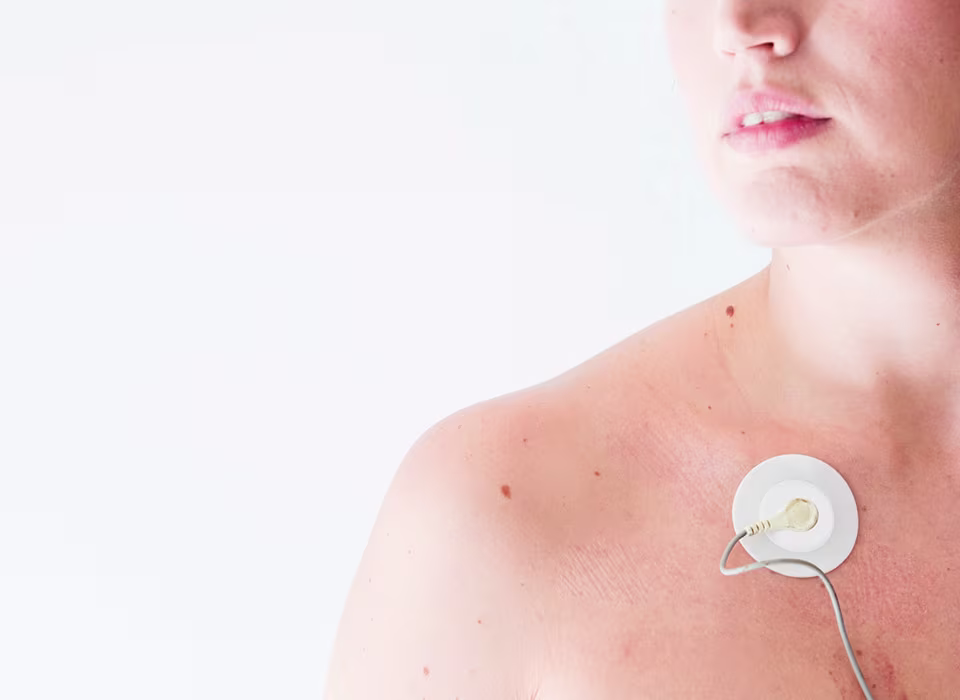 Як проходить видалення папілом у Горизонти?