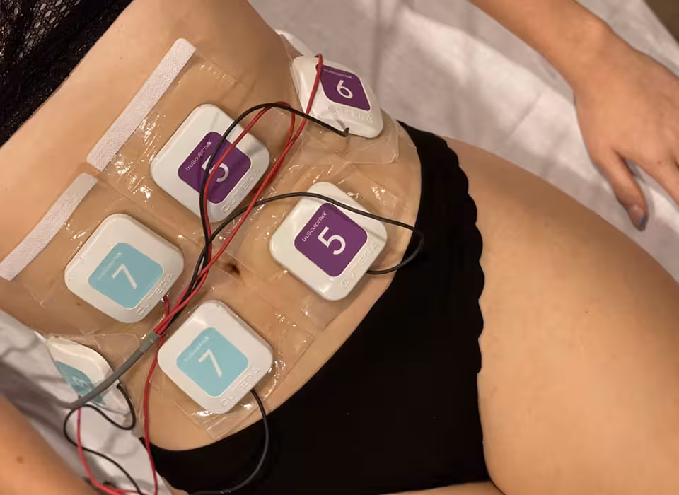 Апаратне скульптурування тіла TruSculpt Flex