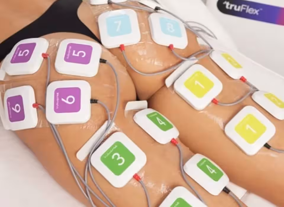 Як працює TruSculpt  Flex